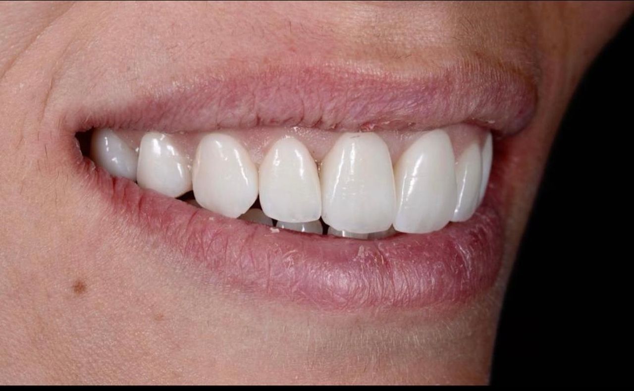 Francesco Sorrentino-0