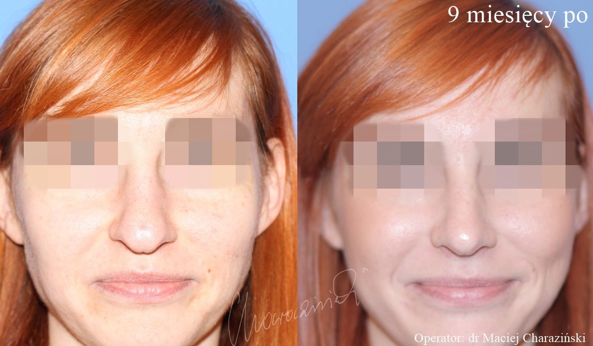 Maciej Charaziński-76