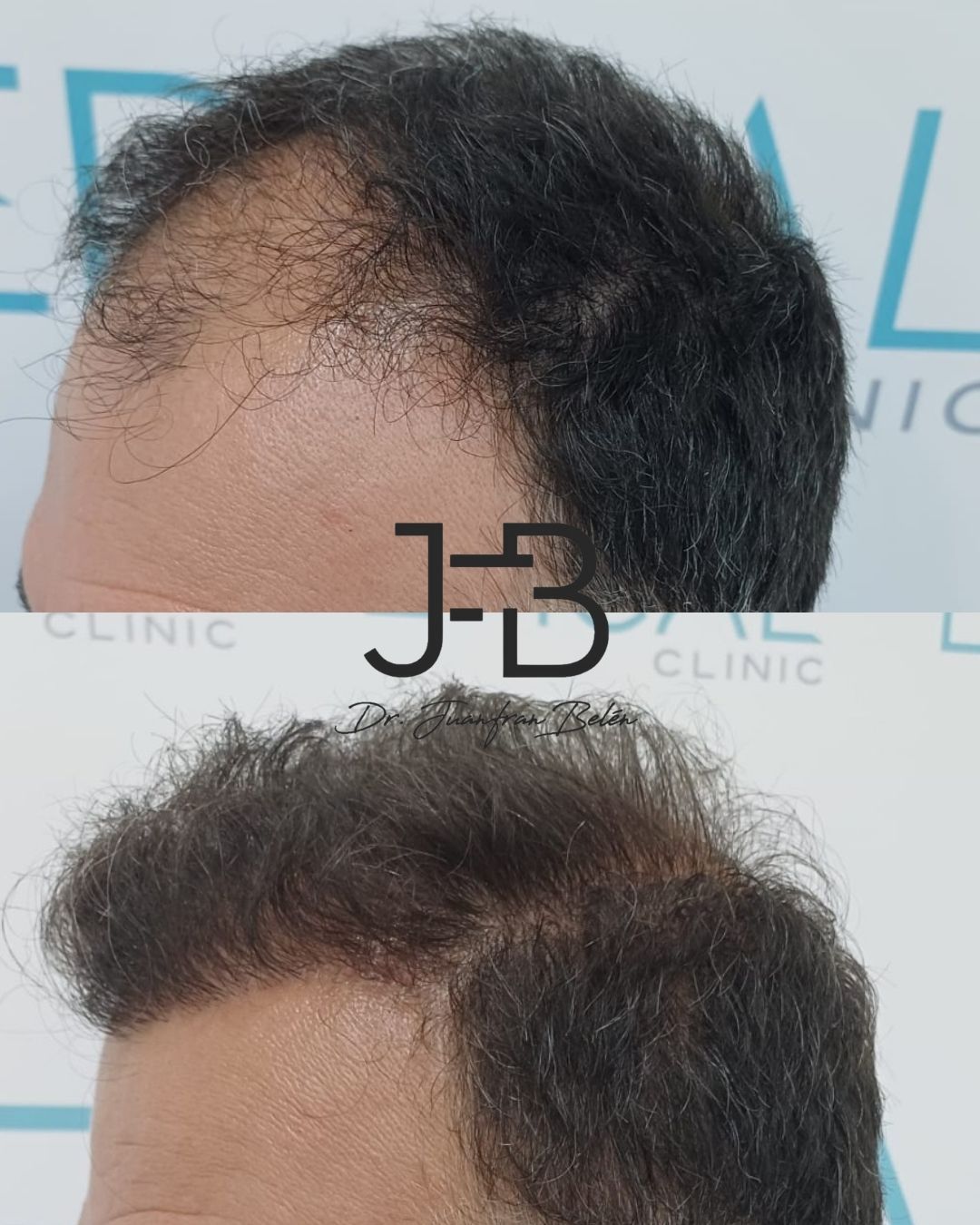 Juan Francisco Belén Montero-39