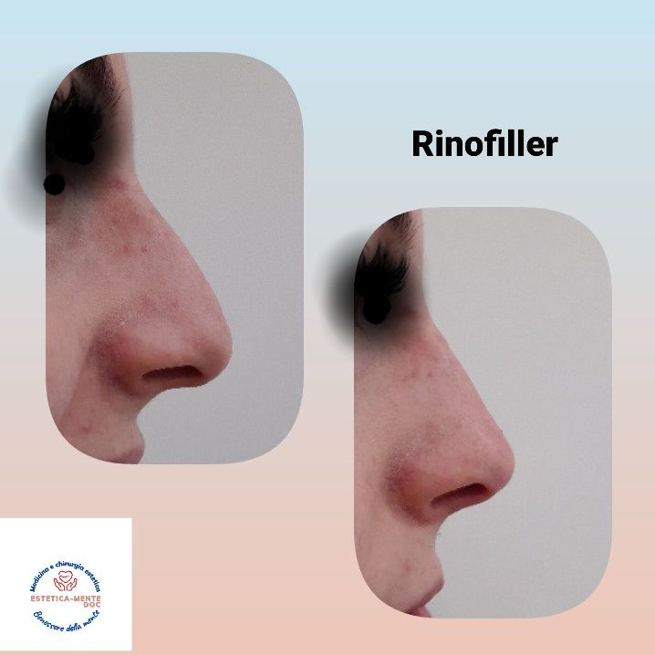 Paola Della Rocca-58