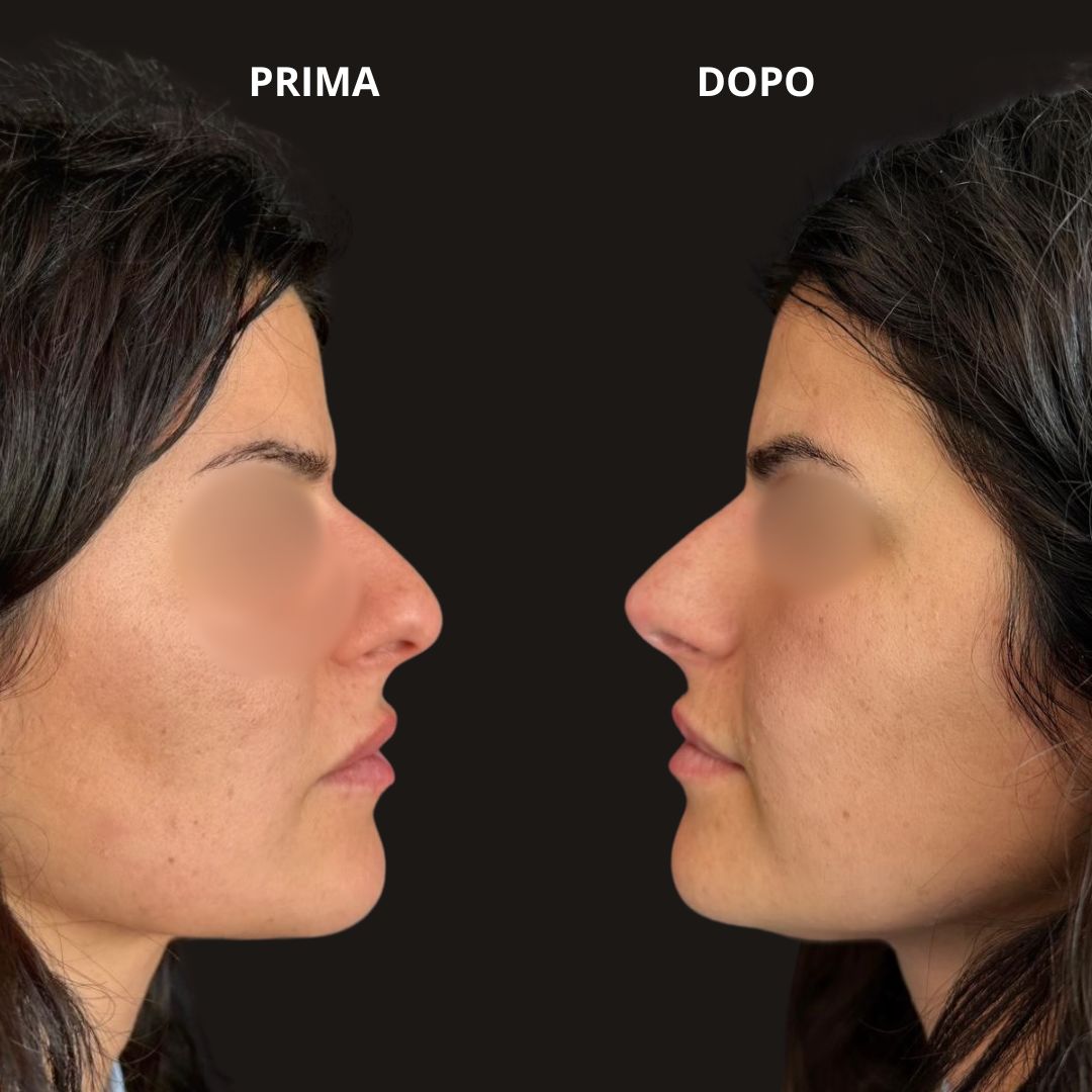 Pierfederico Perazzini-4