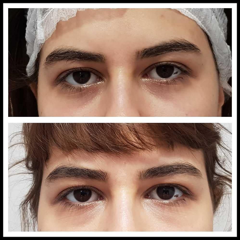 Rosalba Herrero Zerpa-364