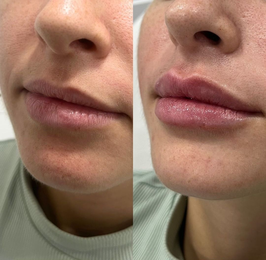 Juan Francisco Belén Montero-41