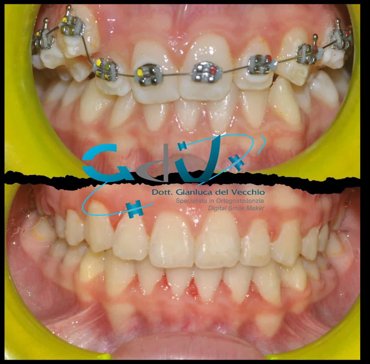 Gianluca Del Vecchio-155