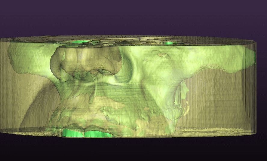 Alessandro Palumbo-12