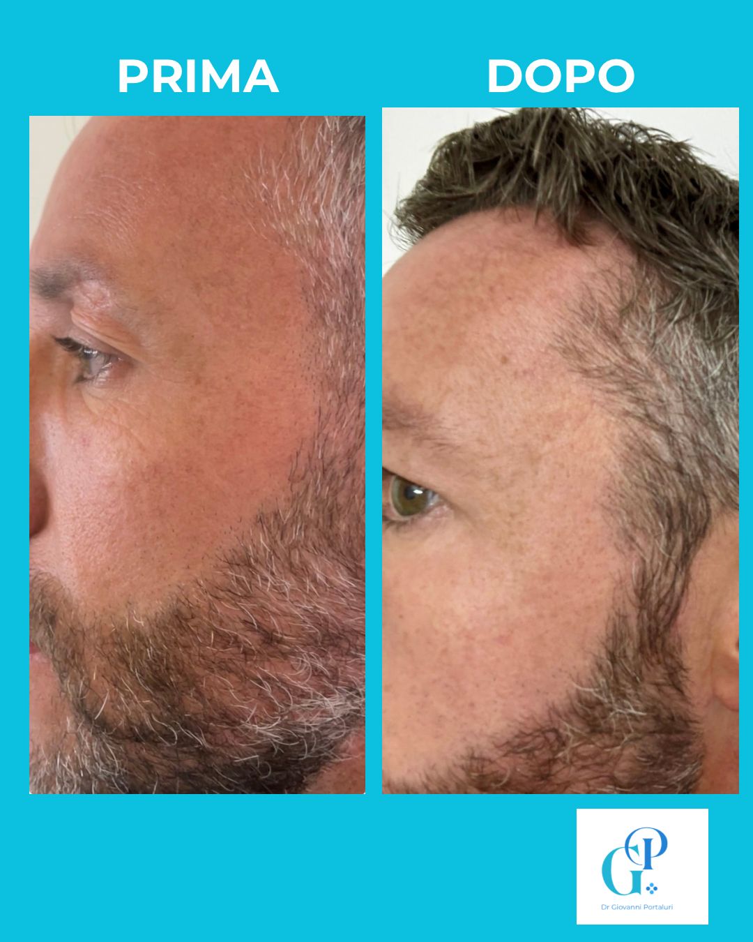 Giovanni Portaluri-0