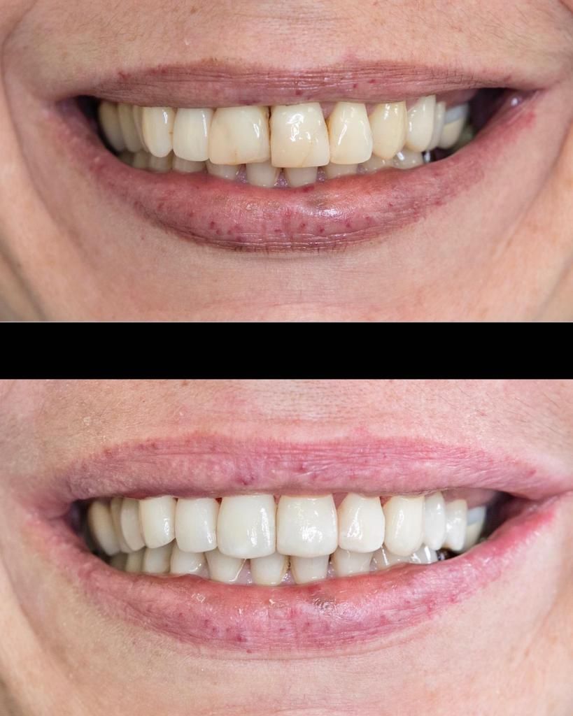 Giampiero Piccione-5