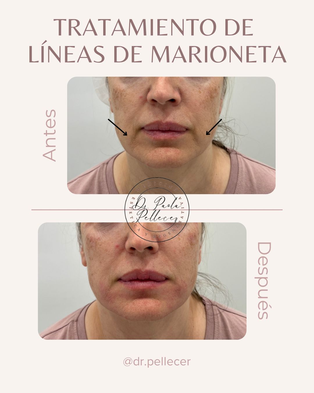 Liliana Paola Pellecer Ruiz-6