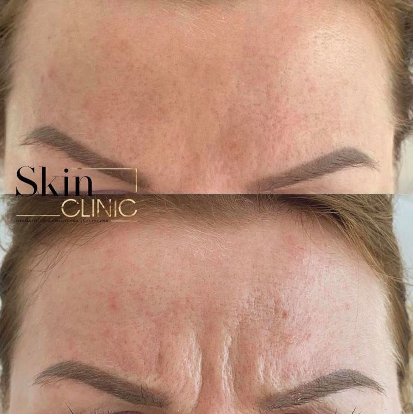 Alina Skrzypek-Salamon-4