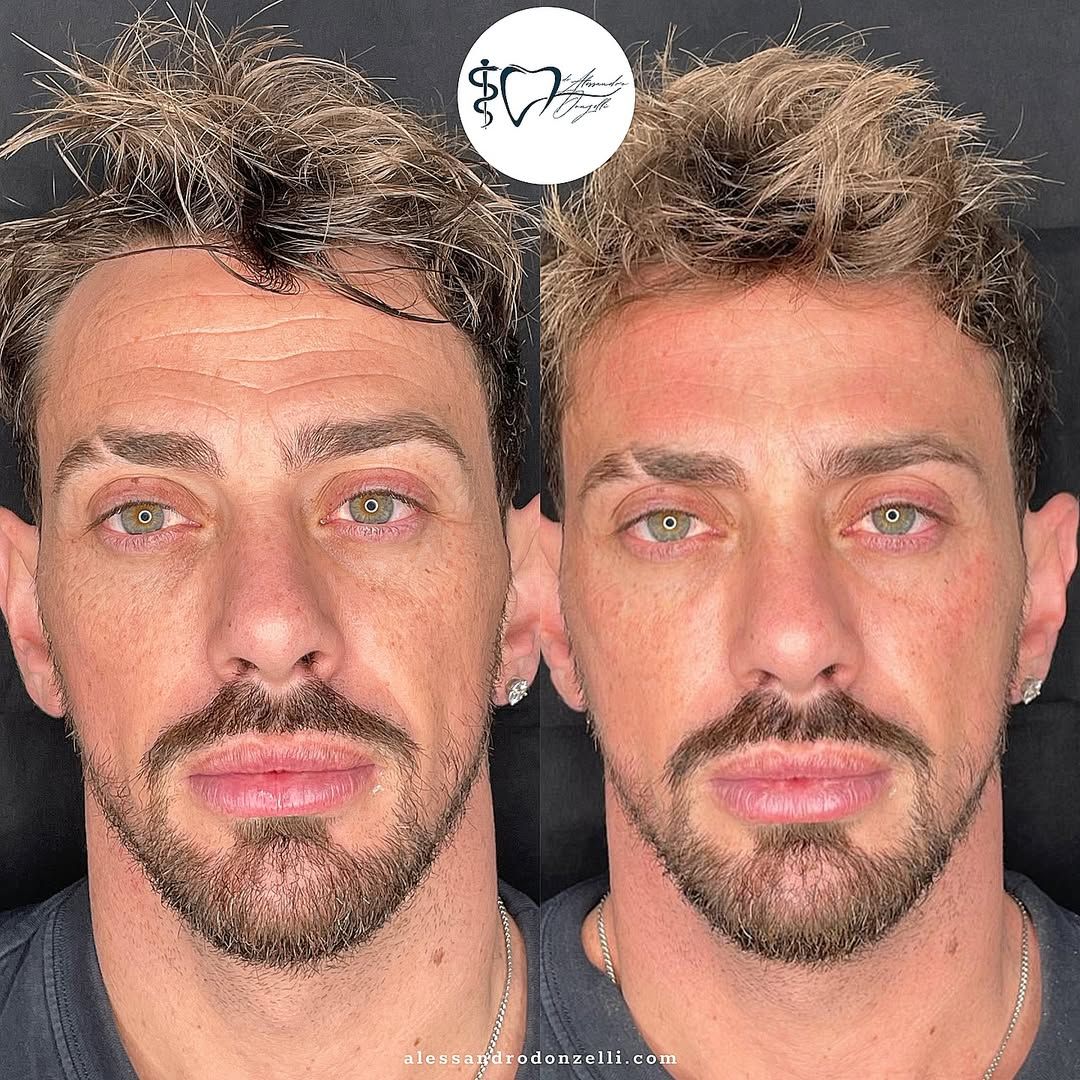 Alessandro Donzelli-15