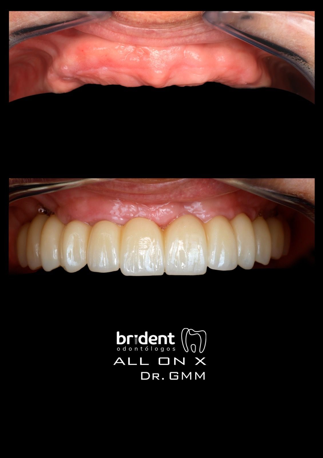 Guillermo Moreno Fragoso-58