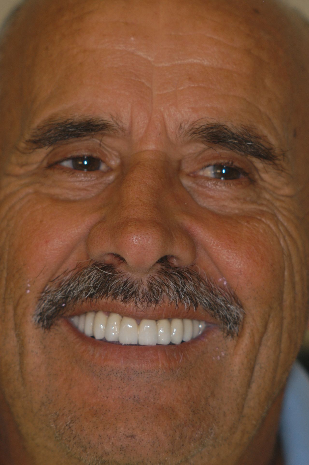 Alessandro Palumbo-24