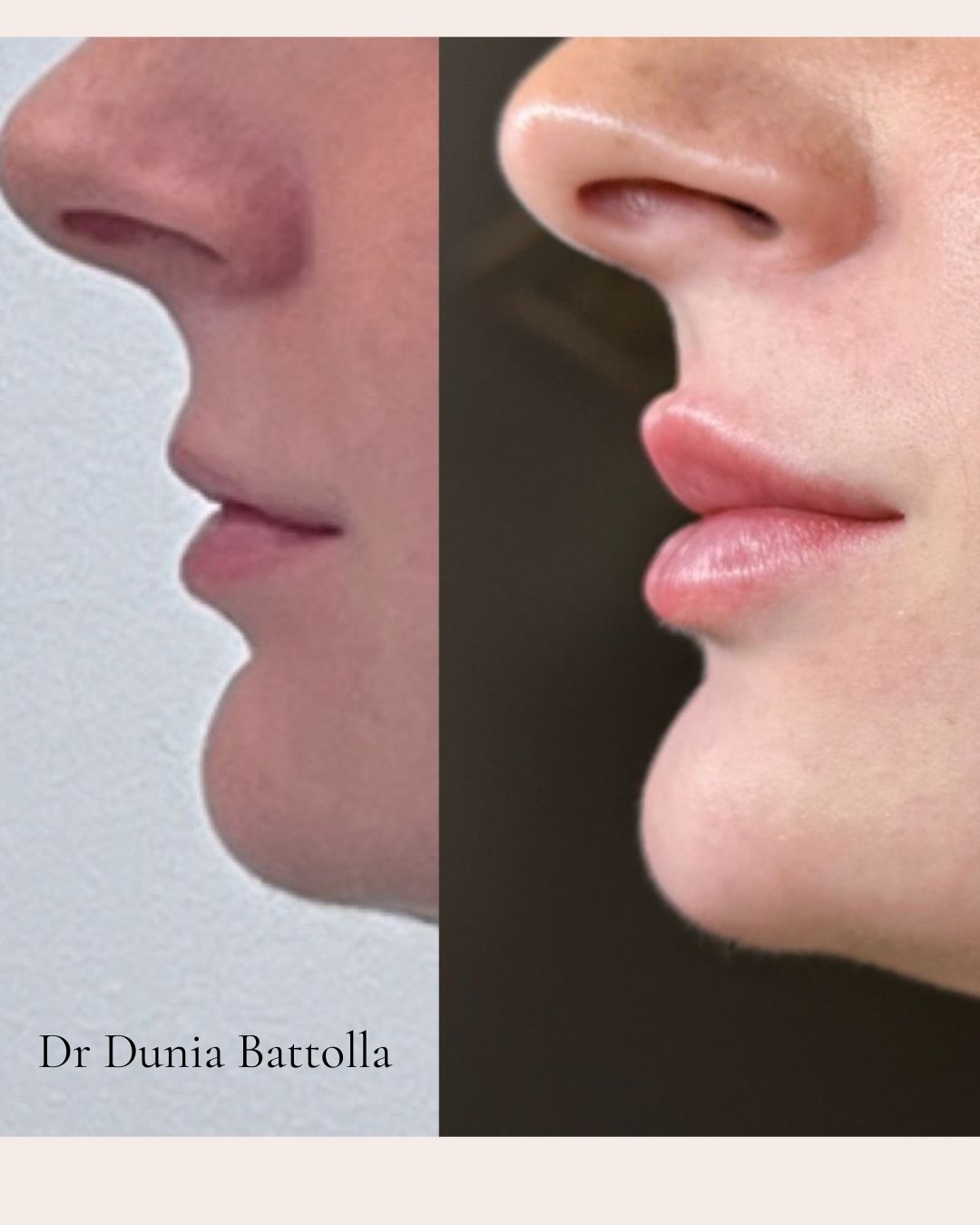 Dunia Battolla-4