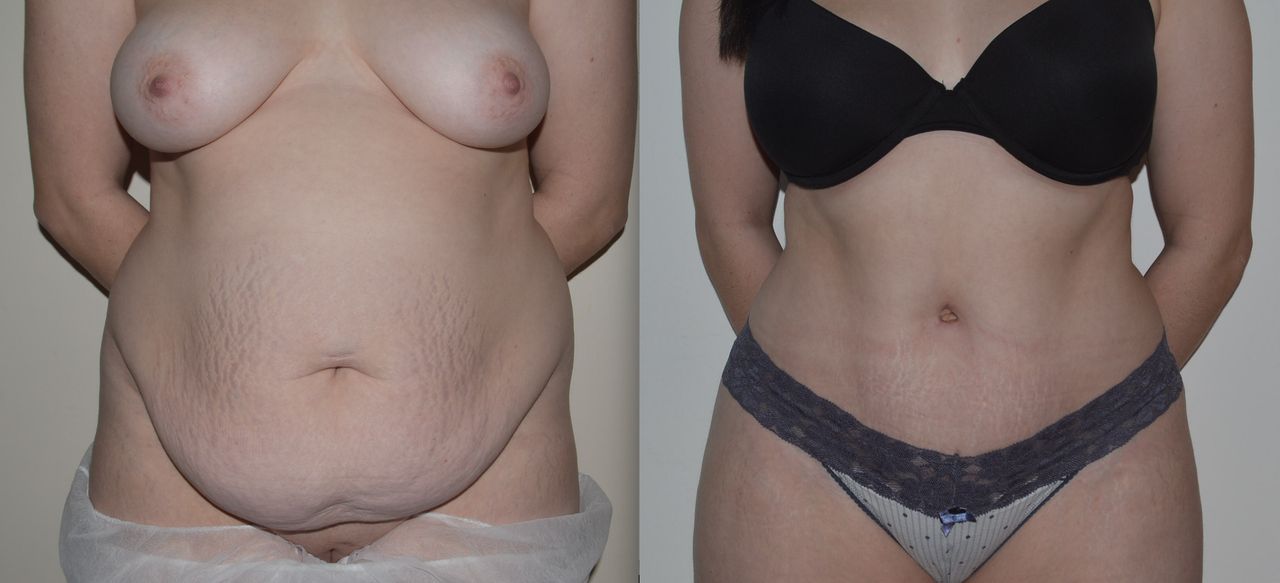 Michele Antonacci-10