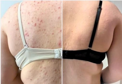 Nuna Quilla Pérez Alonso-2