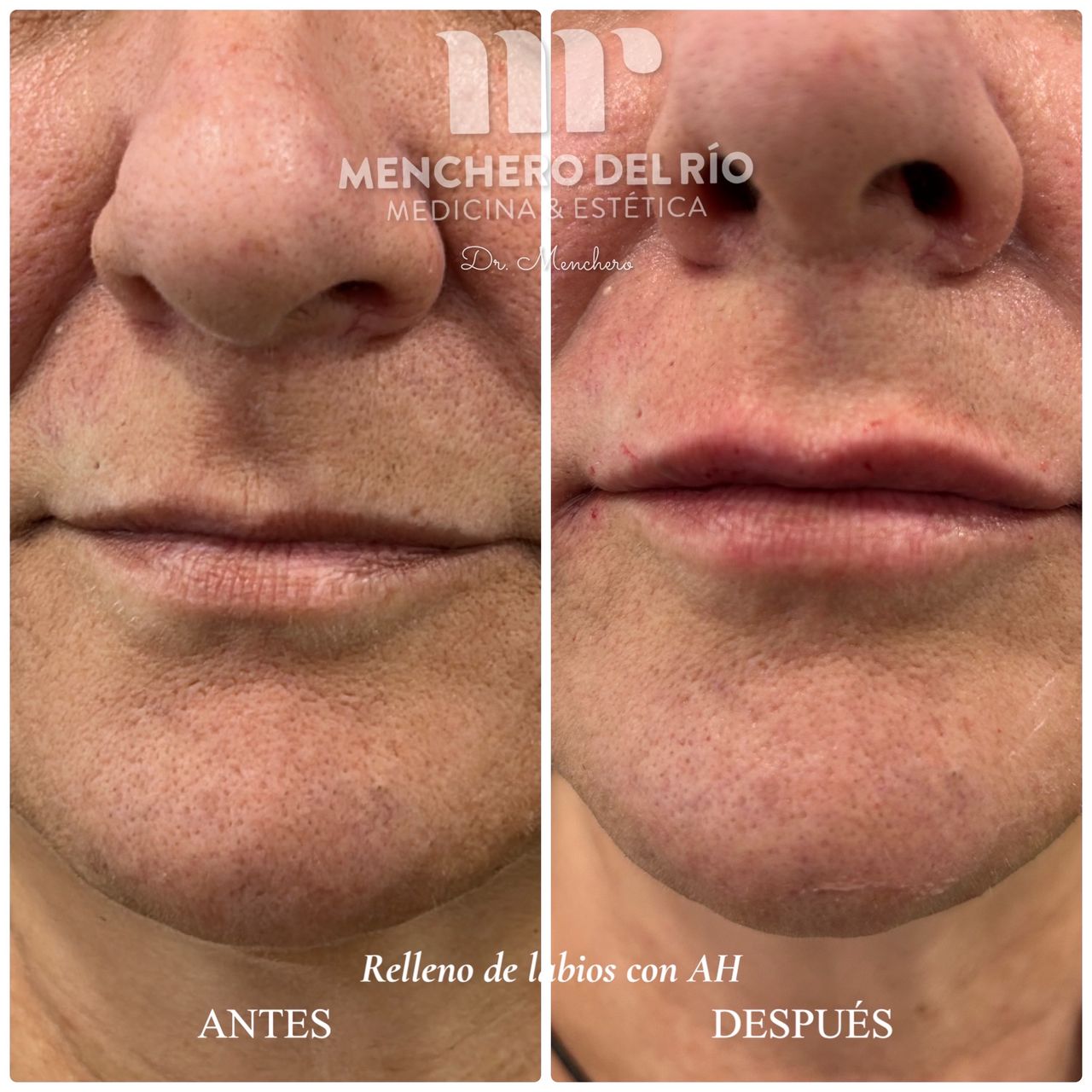 Arsenio Menchero Sánchez-38