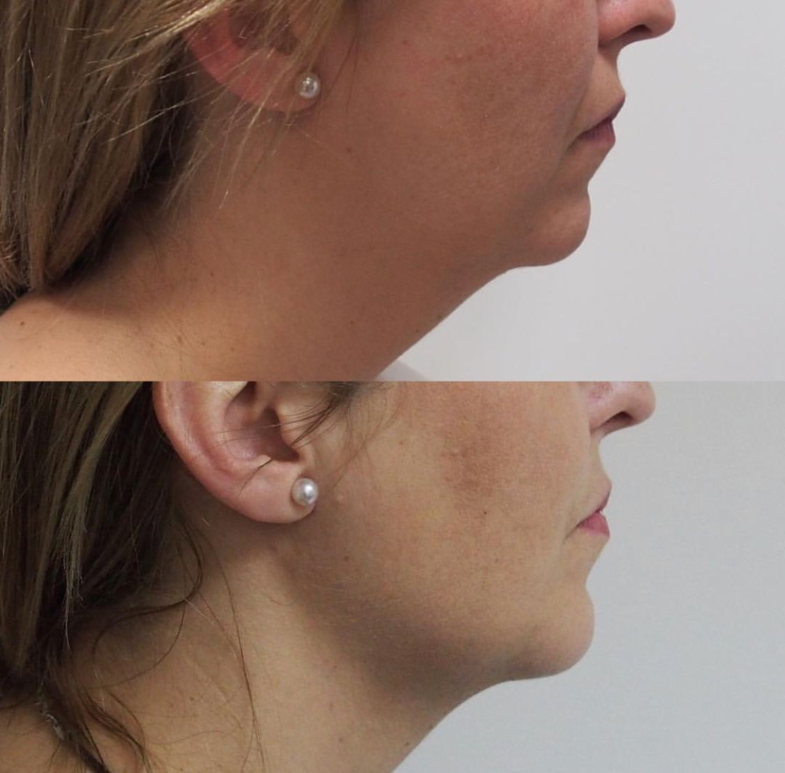 Alberto Candau Álvarez-39