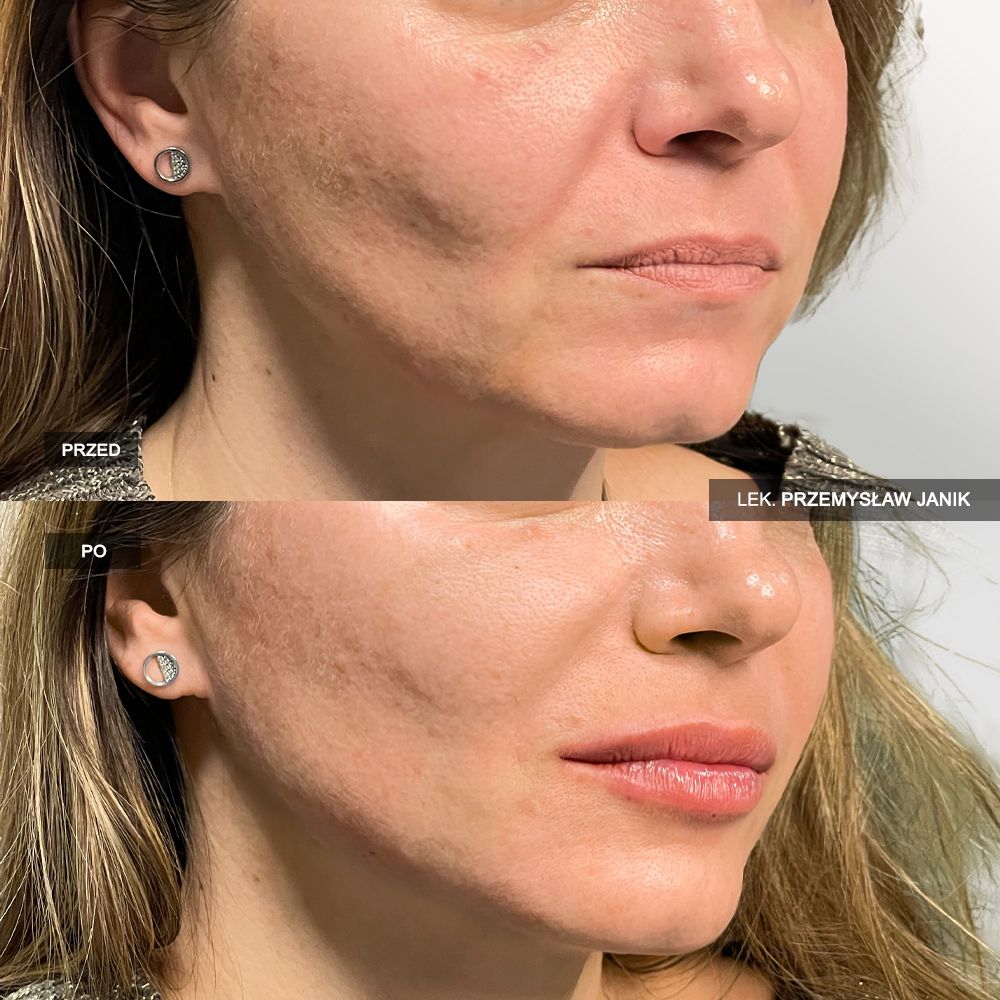 Przemysław Janik-38