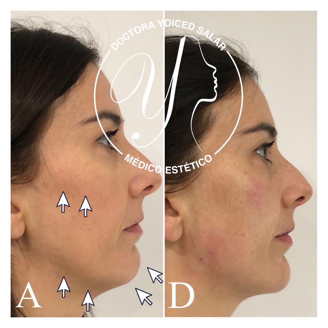 Yoiced Salar Peñate-8