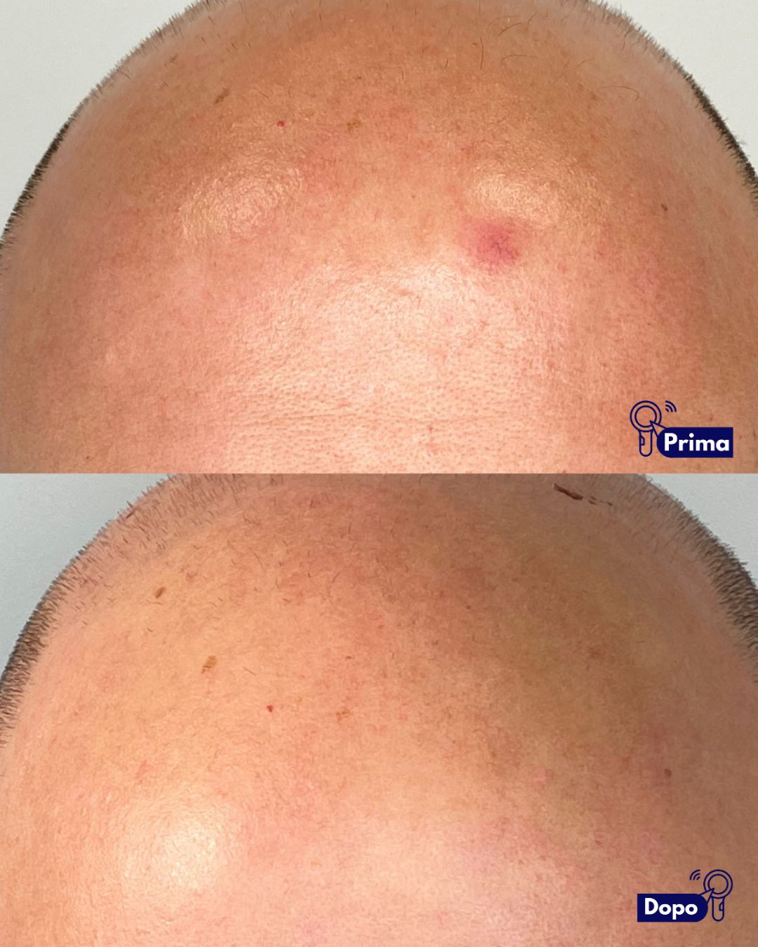 Alfredo Piccerillo-4