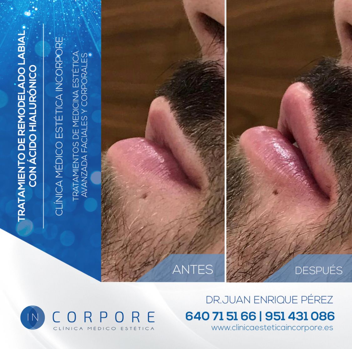 Juan Enrique Pérez Enríquez-101