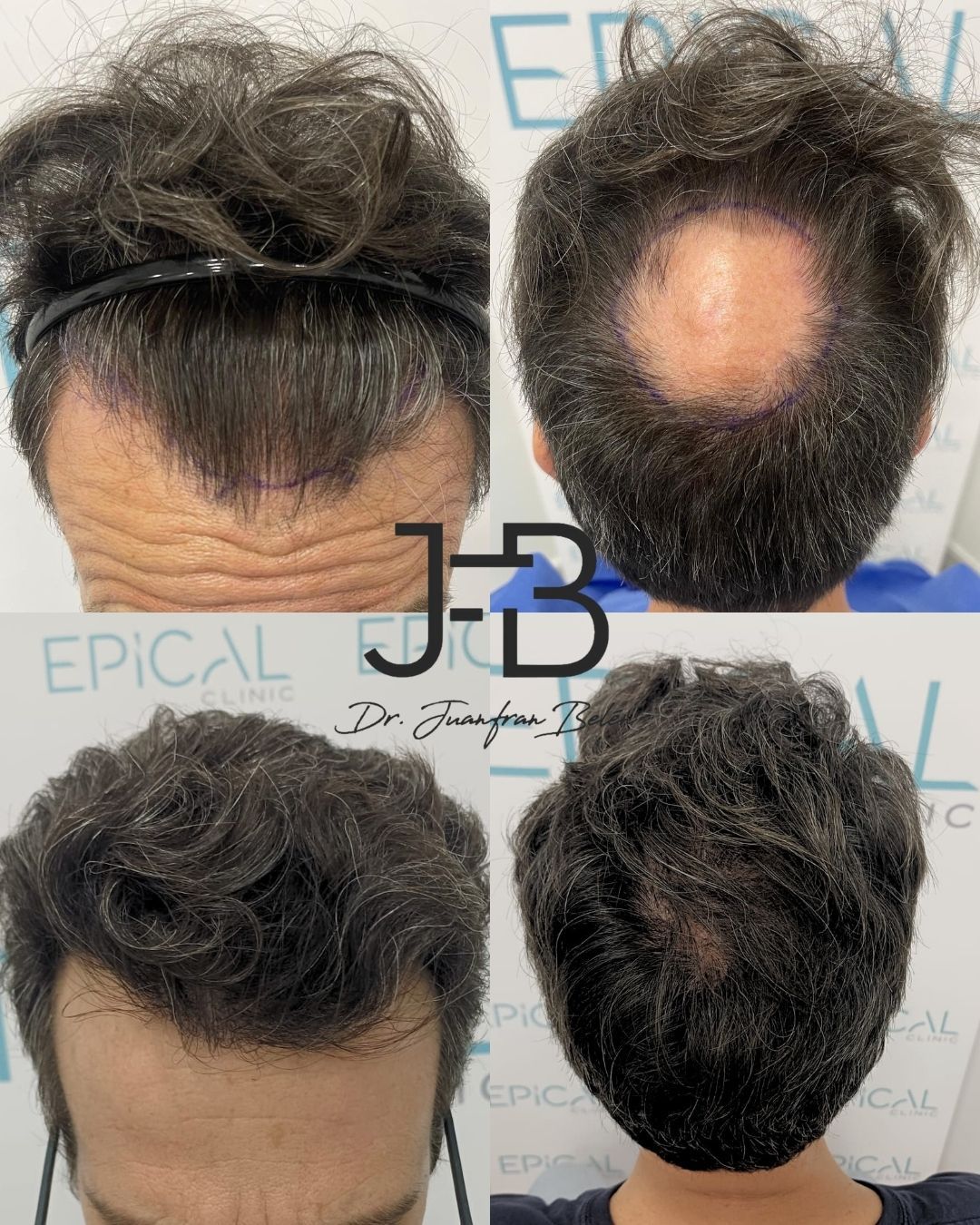 Juan Francisco Belén Montero-13