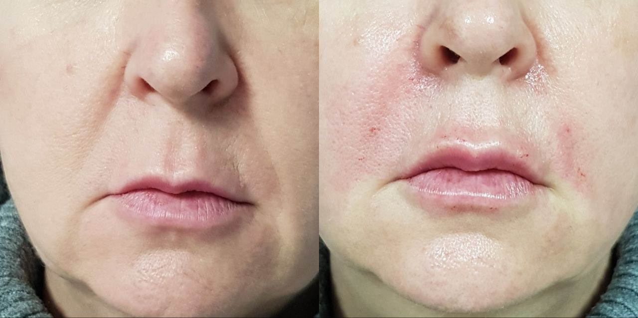 Rosalba Herrero Zerpa-117