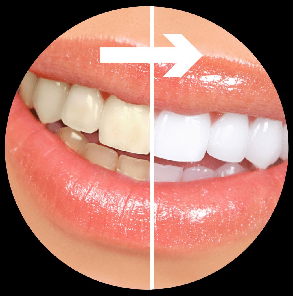 Antonio Grande-4