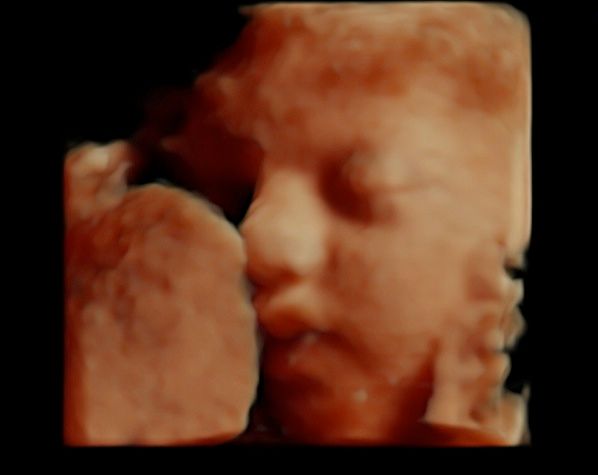 Tommaso Incandela-55