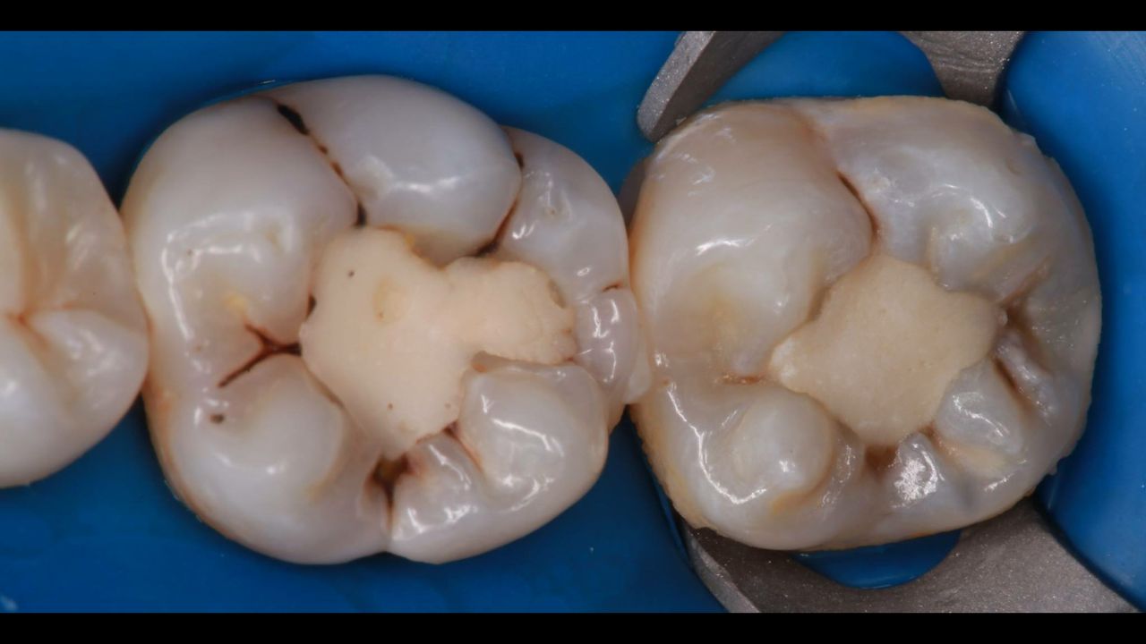 Volodymyr Kachmar-15