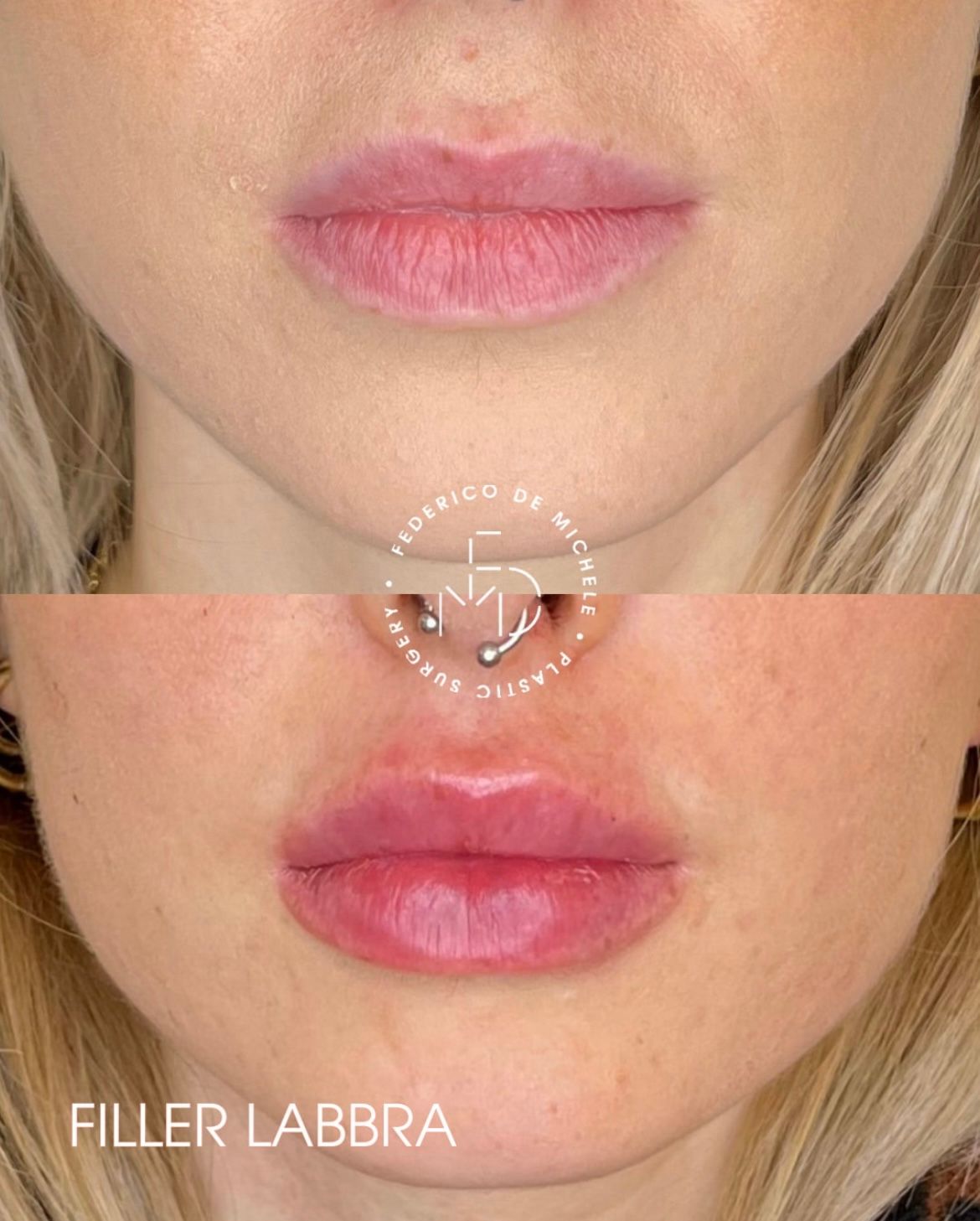 Federico De Michele-14