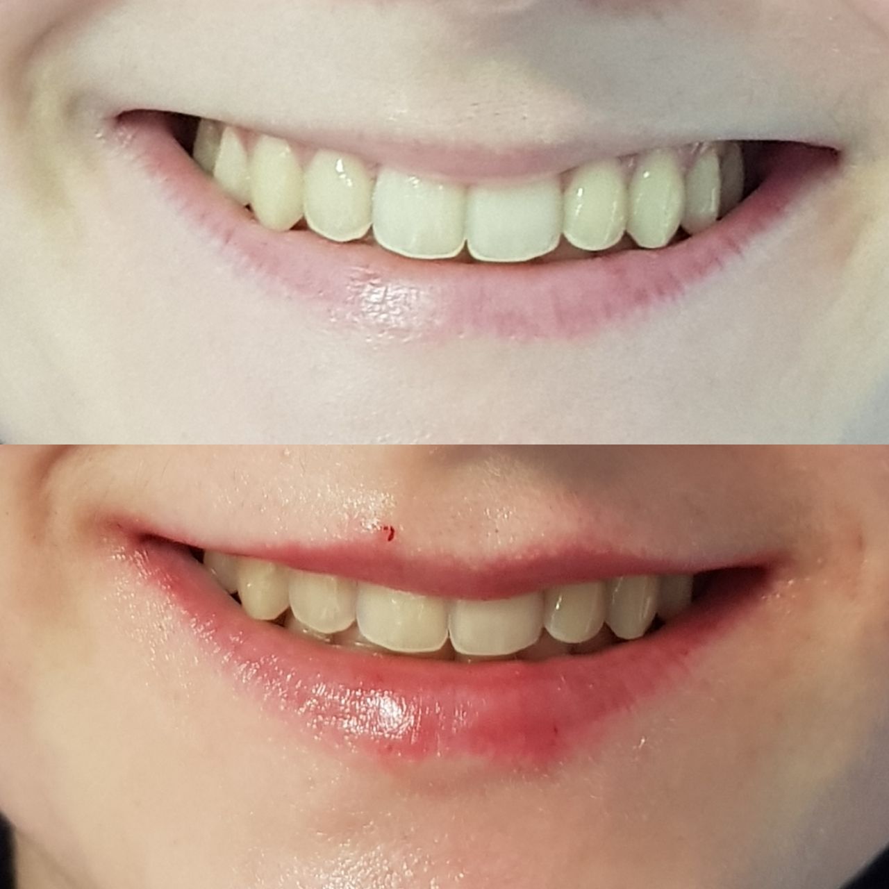 Rosalba Herrero Zerpa-206