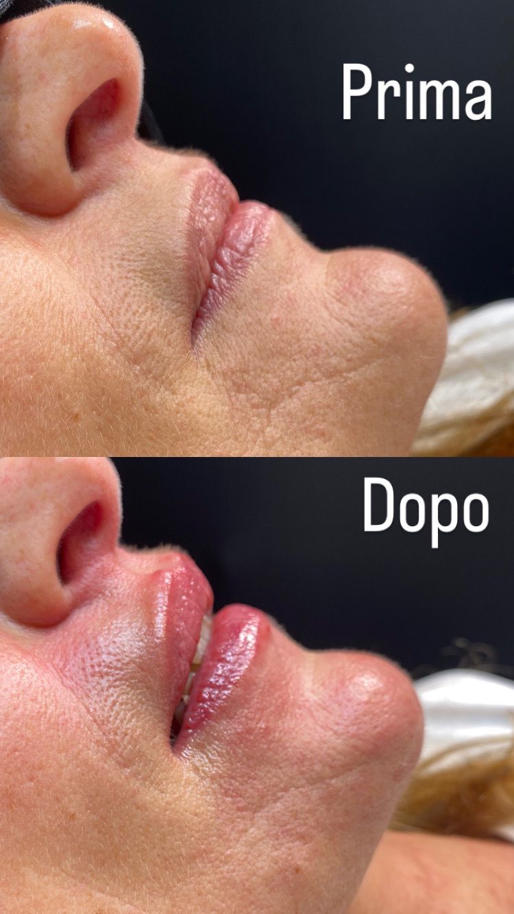 Alberto Alessandri-3