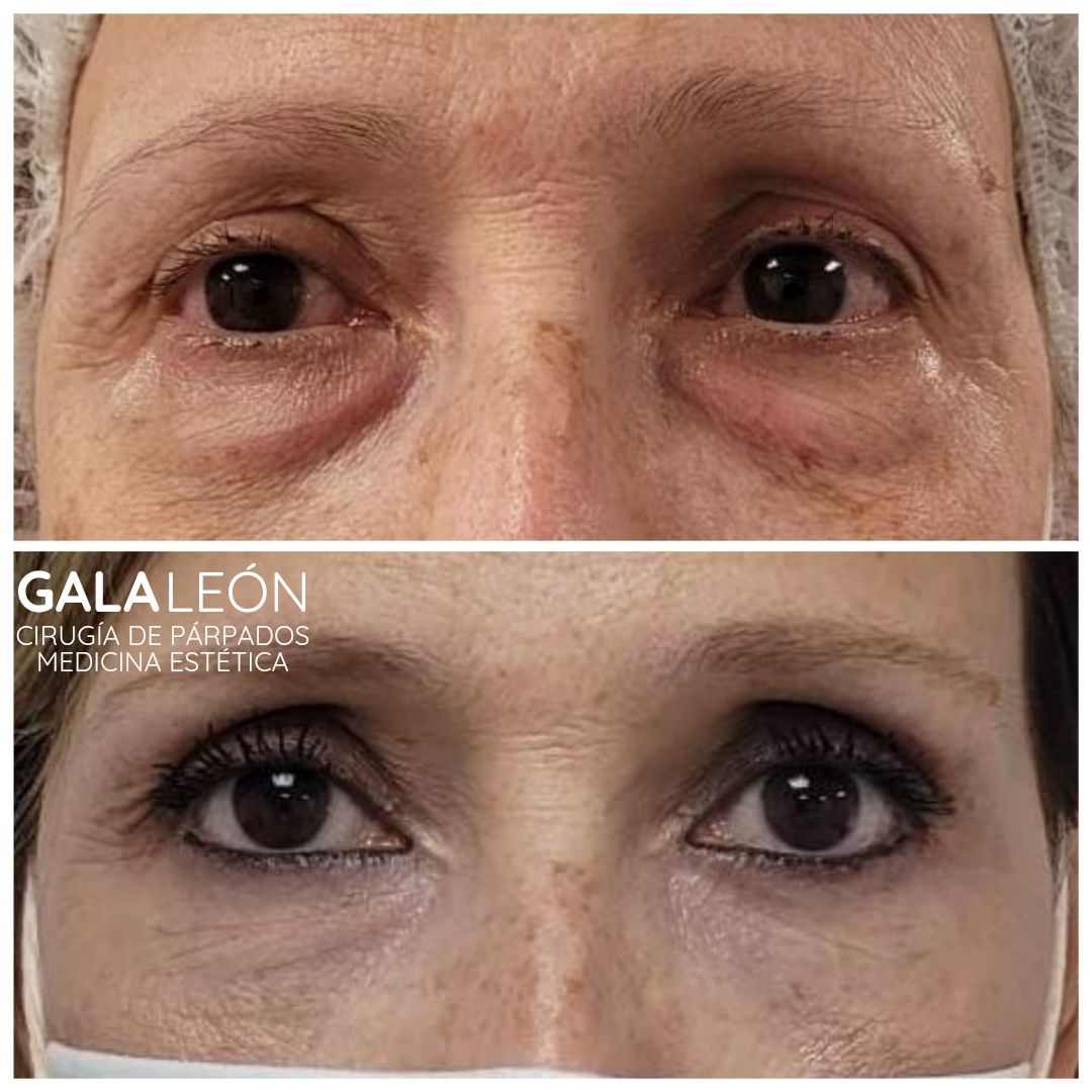 Gala P. Leon Salvatierra-10