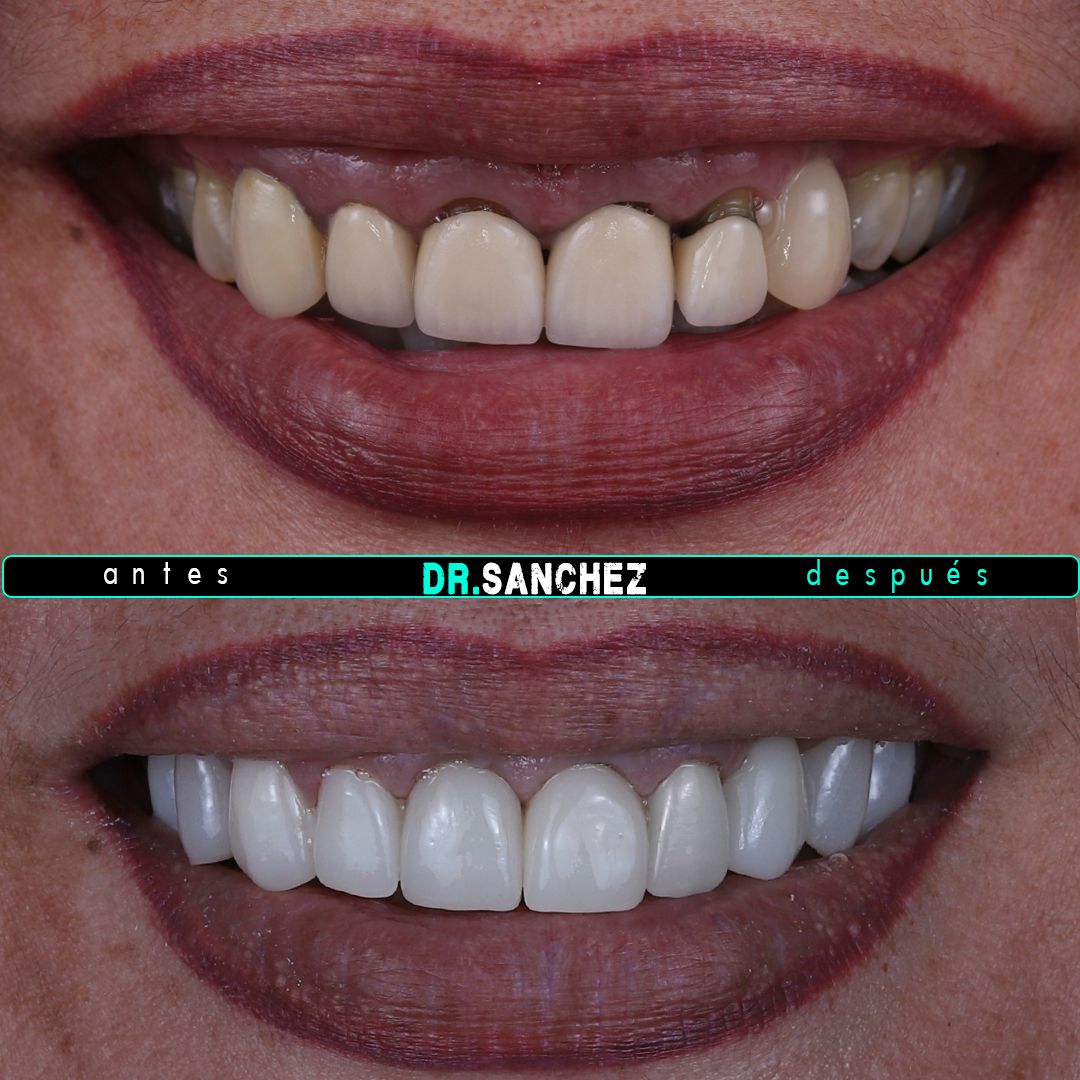 Juan Carlos Sánchez Pérez-2