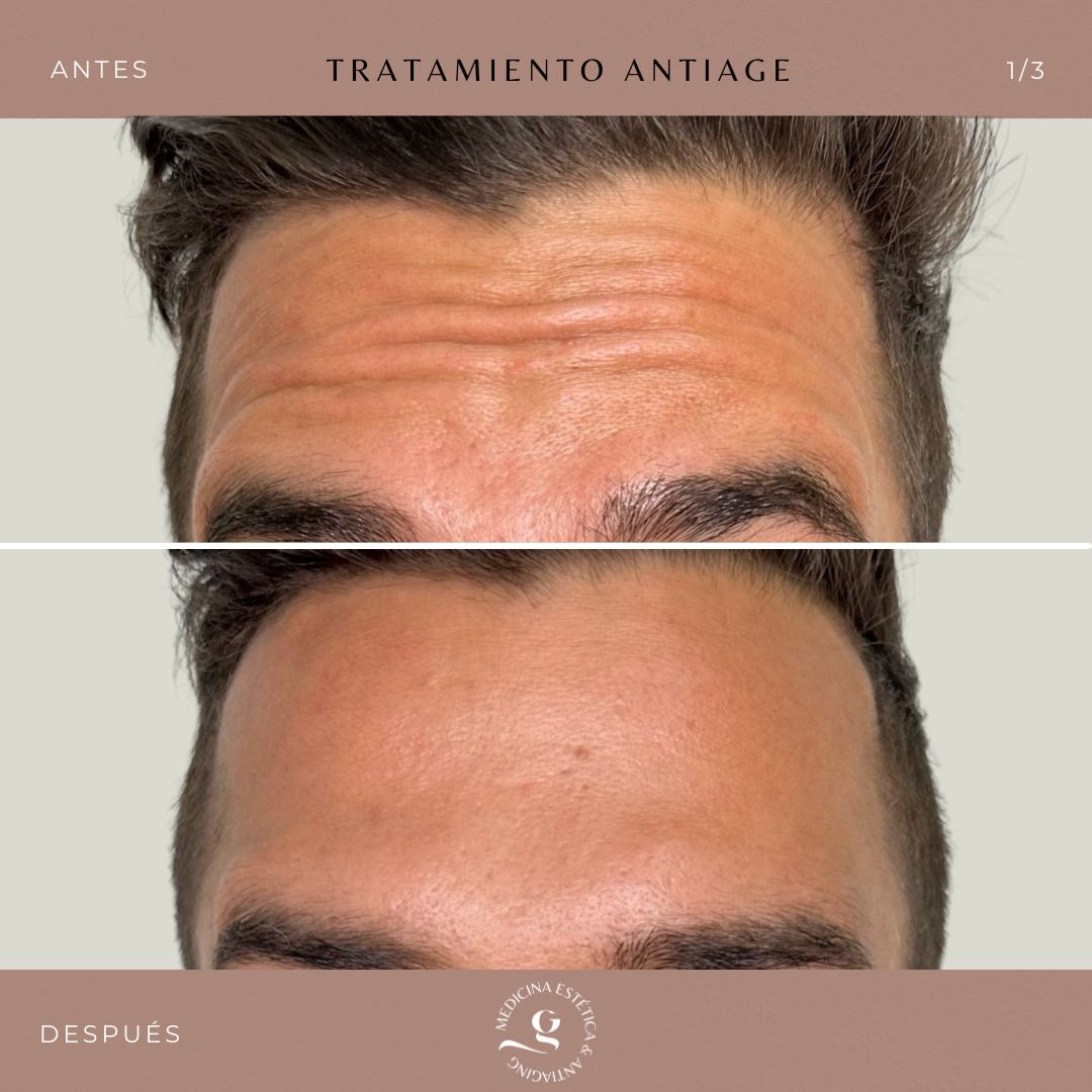 ​Giovanni Giorgianni-6