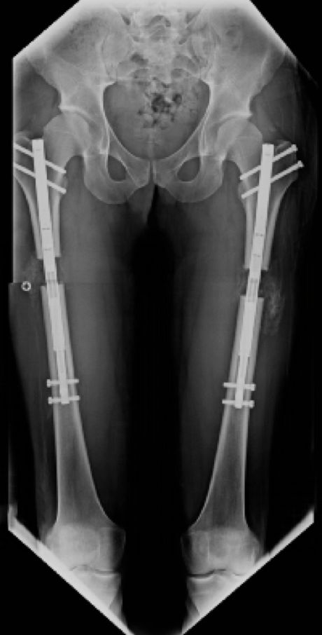 Jarosław Michał Deszczyński-3