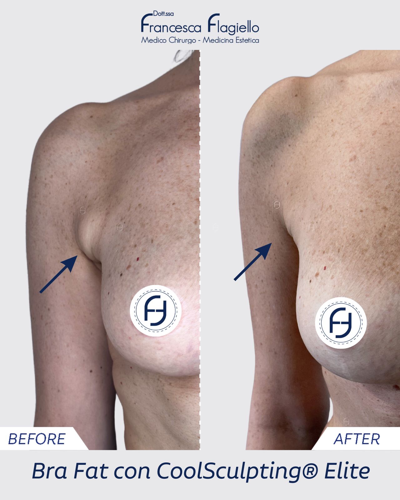 Francesca Flagiello-3