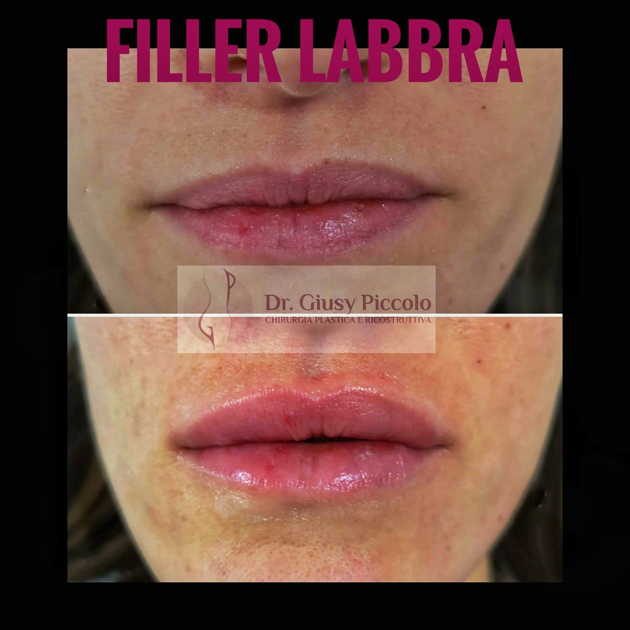 Giuseppina Piccolo-46