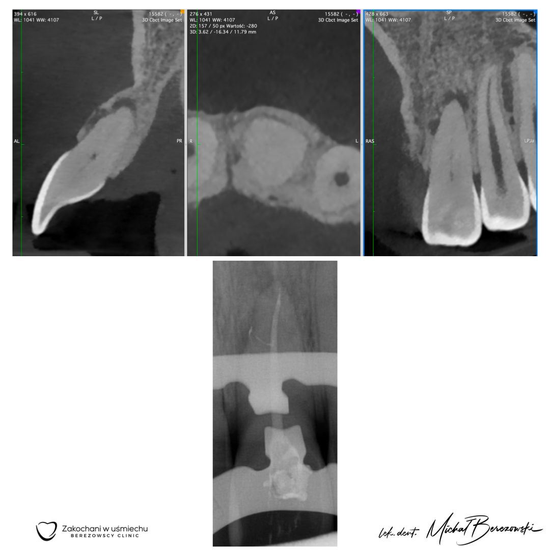 Michał Berezowski-50