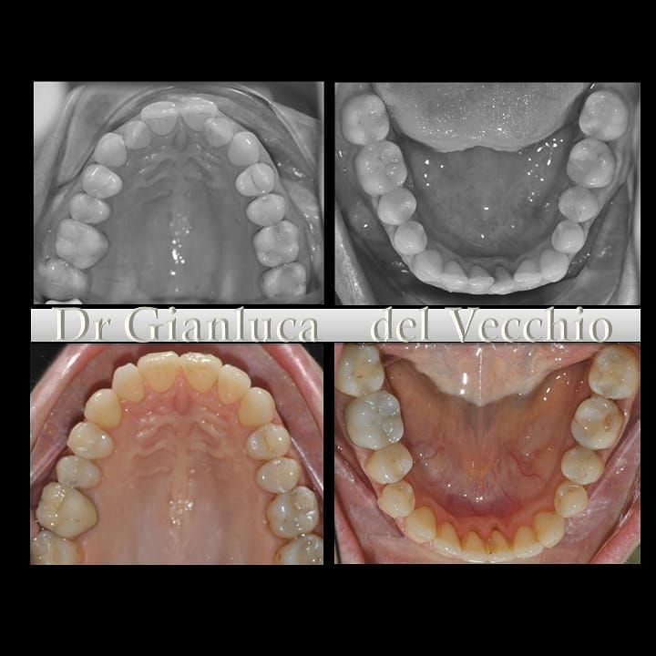 Gianluca Del Vecchio-61