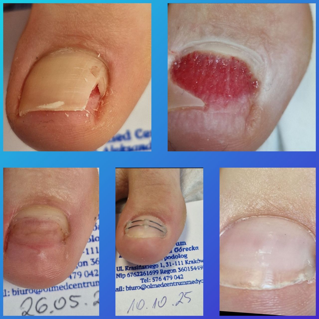 Aleksandra  Górecka -13