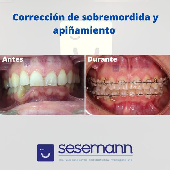 Paula Cano Carrillo-79