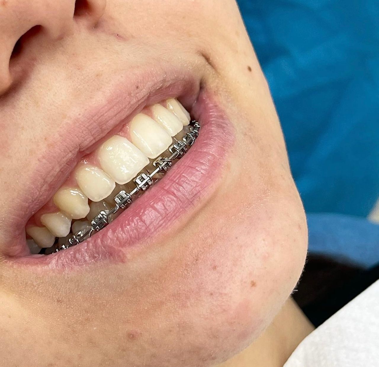 Francesco Sorrentino-5