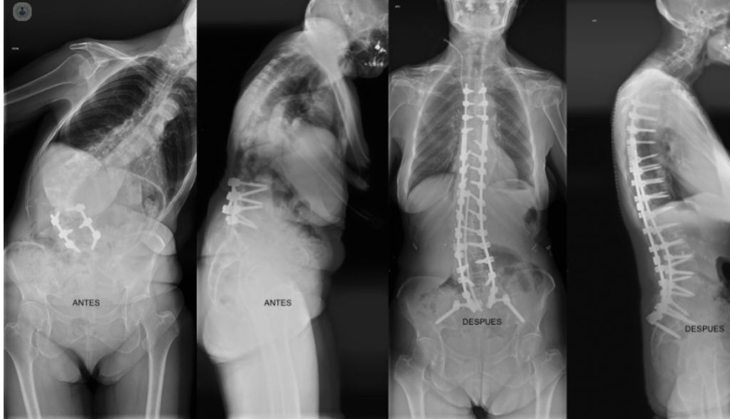 Nicomedes Fernandez-Baillo Gallego Sacristana-10