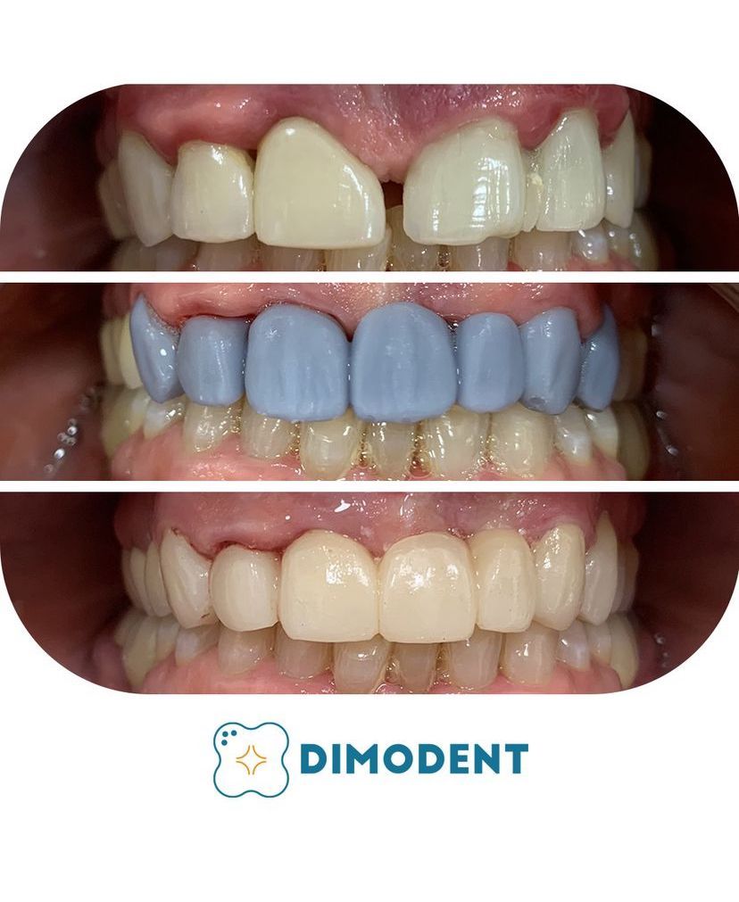 Marcello Di Monaco-13