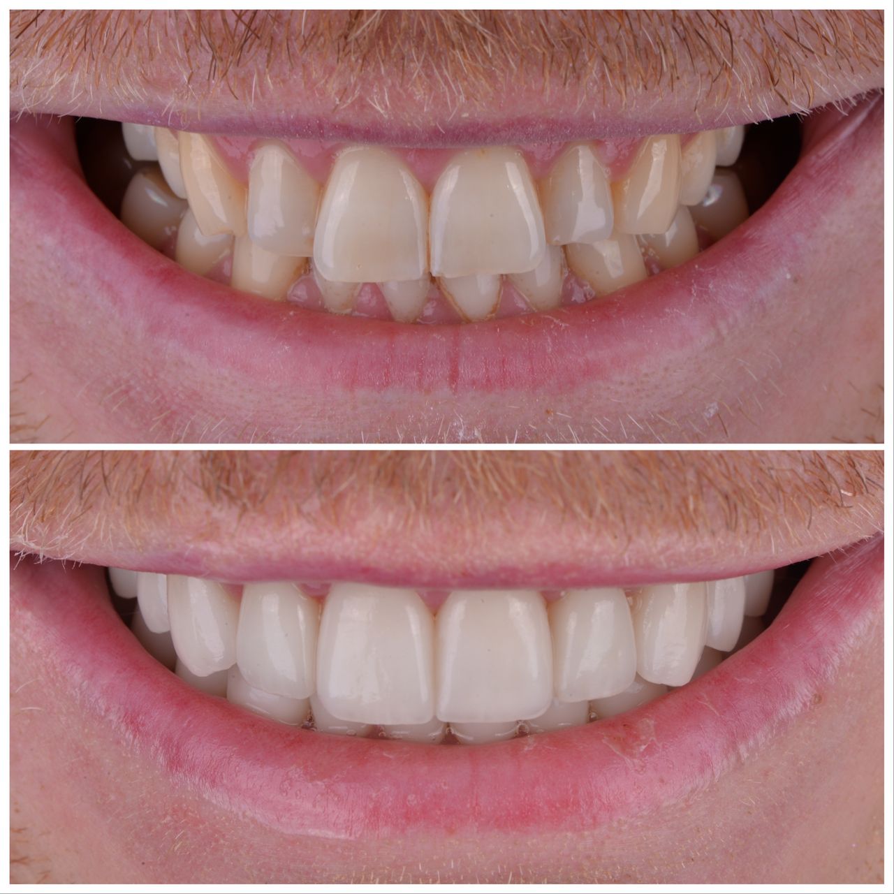 Martin Bartoszcze-28