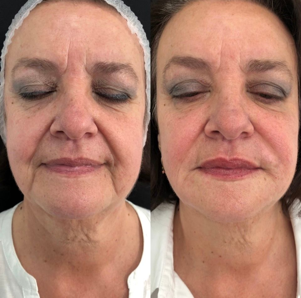 Raffaele Del Prete-6