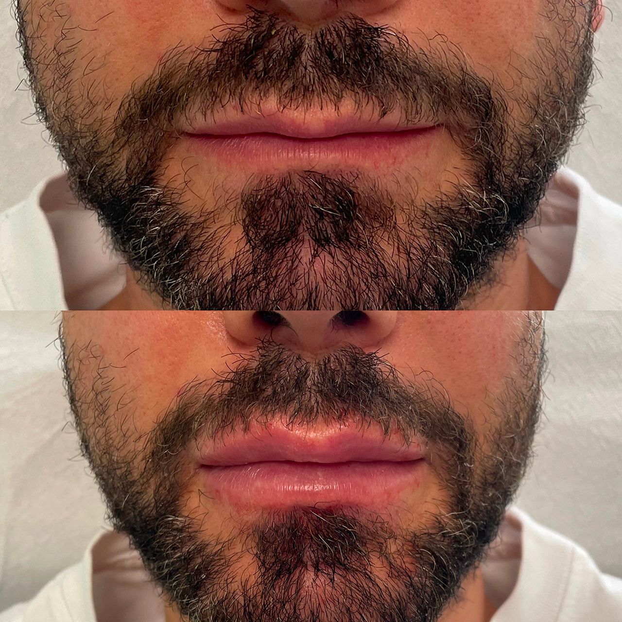 Marco Carmisciano-17