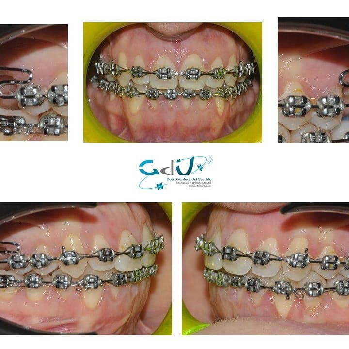 Gianluca Del Vecchio-103